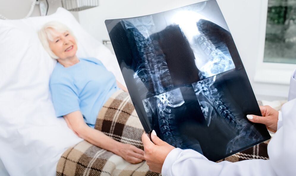diagnostyka osteochondrozy