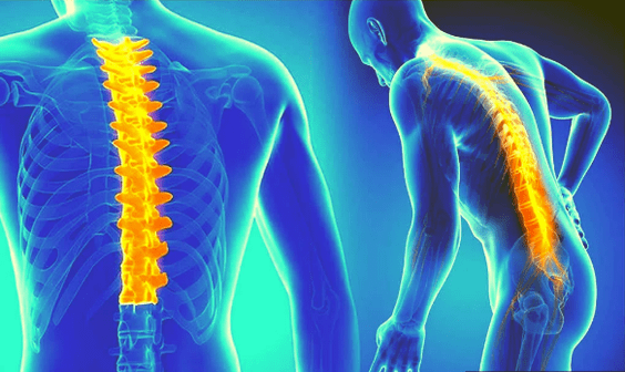 Osteochondroza kręgosłupa